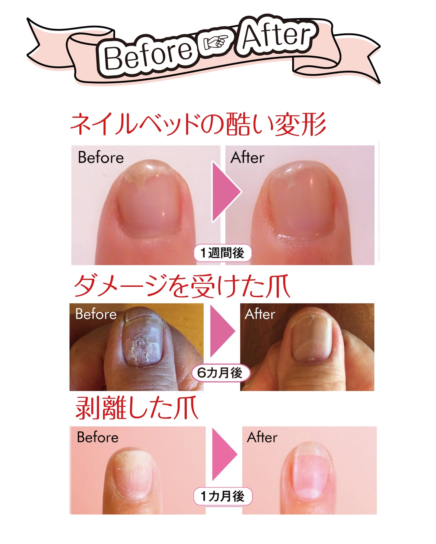 ネイルリペアエッセンスネイルセラム’ルーロ ローズの香り